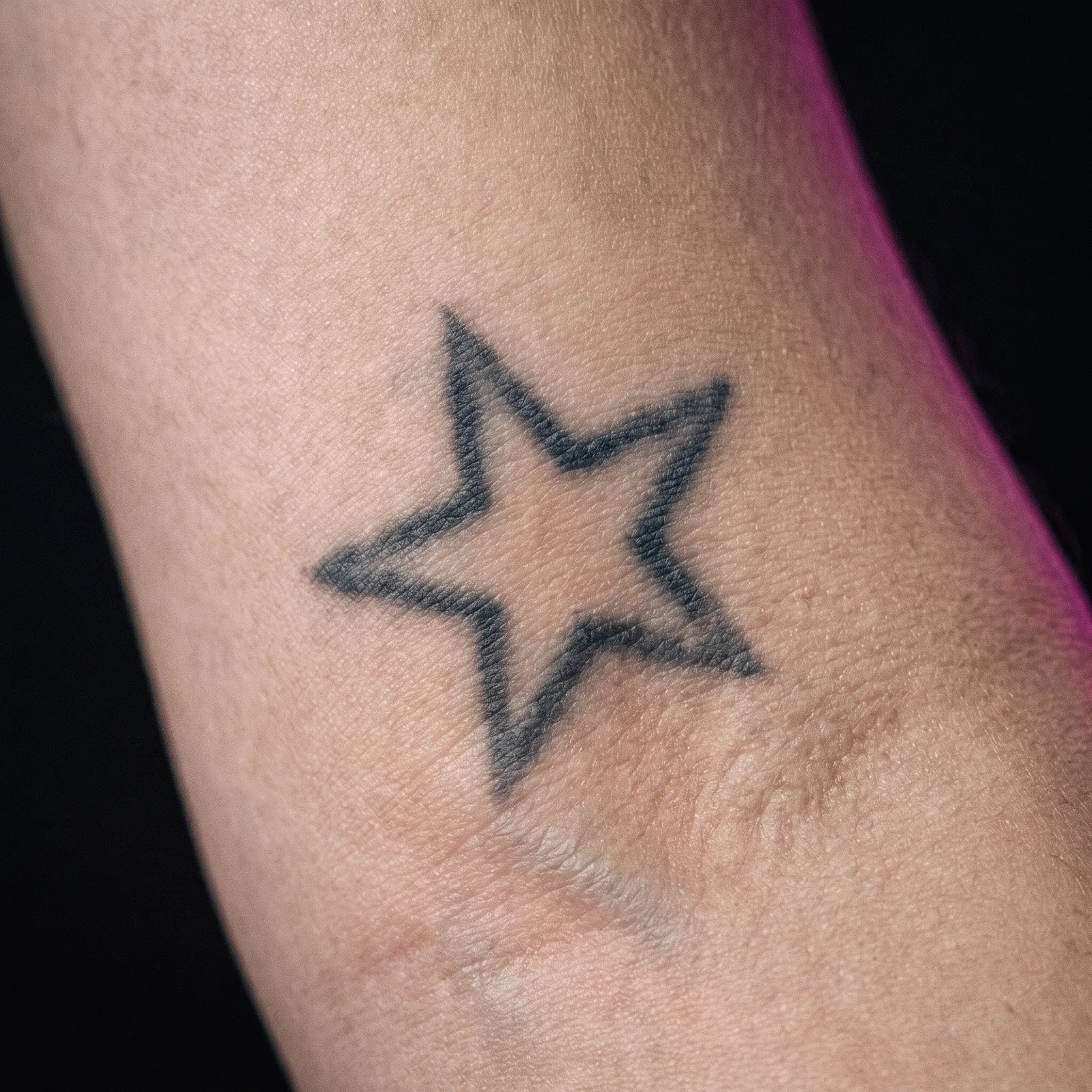 Faded decade-old star tattoo before a cover-up session